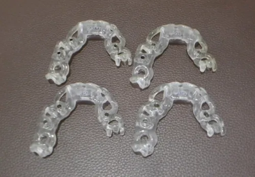 インプラント治療