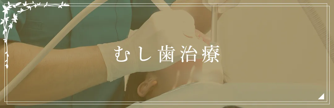 むし歯治療