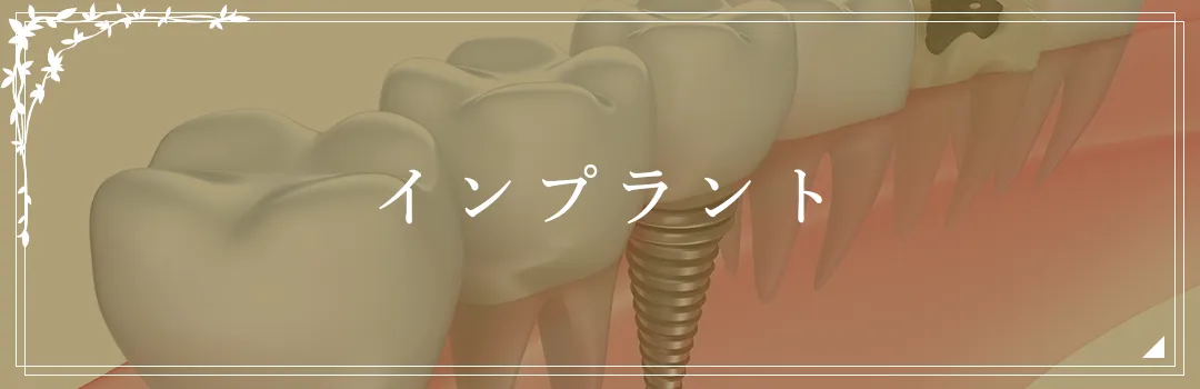 インプラント