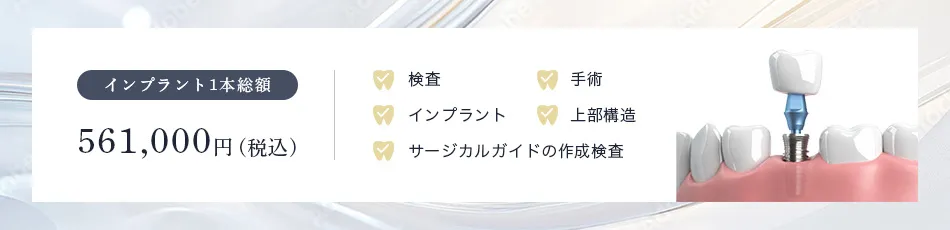 インプラントの料金