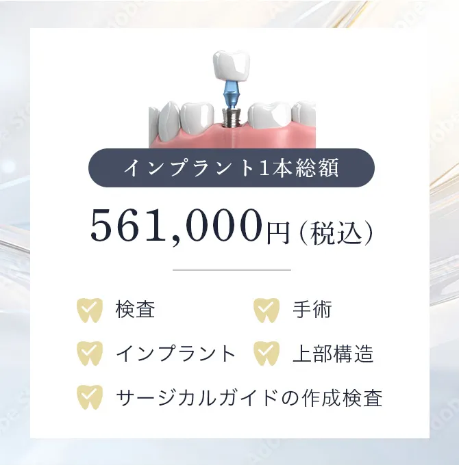 インプラントの料金